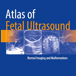 Atlas of Fetal Ultrasound: Normal Imaging and Malformations