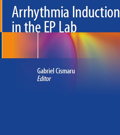  Arrhythmia Induction in the EP Lab