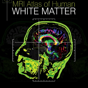 MRI Atlas of Human White Matter
