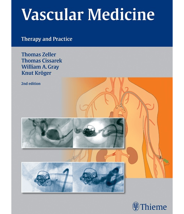 Vascular Medicine: Therapy and Practice 