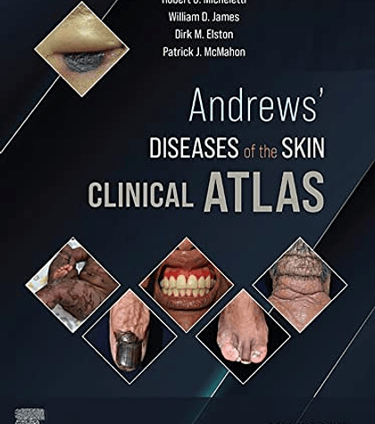 Andrews' Diseases of the Skin Clinical Atlas