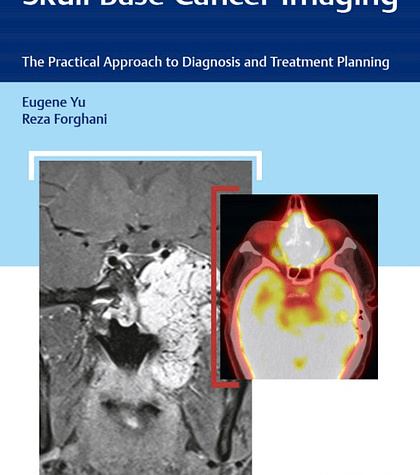 Skull Base Cancer Imaging: The Practical Approach to Diagnosis and Treatment Planning