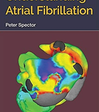 Understanding Atrial Fibrillation