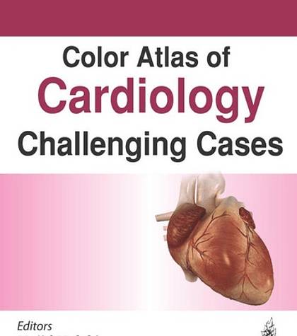  Color Atlas of Cardiology: Challenging Cases 