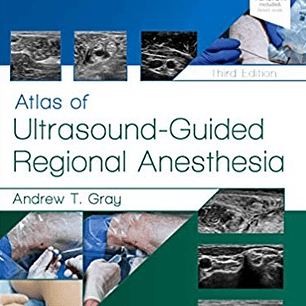 Atlas of Ultrasound-Guided Regional Anesthesia