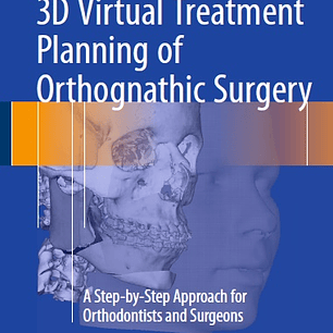3D Virtual Treatment Planning of Orthognathic Surgery: A Step-by-Step Approach for Orthodontists and Surgeons