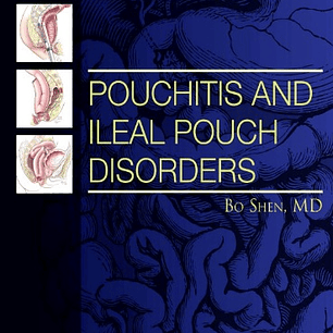 Pouchitis and Ileal Pouch Disorders: A Multidisciplinary Approach for Diagnosis and Management