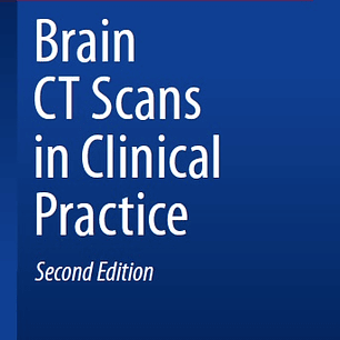 Brain CT Scans in Clinical Practice