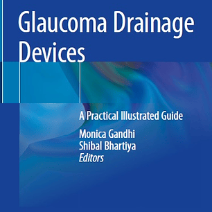Glaucoma Drainage Devices: A Practical Illustrated Guide