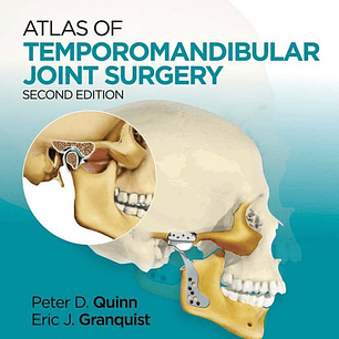 Atlas of Temporomandibular Joint Surgery
