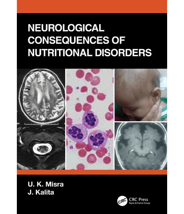 Neurological Consequences of Nutritional Disorders