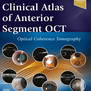 Clinical Atlas of Anterior Segment OCT: Optical Coherence Tomography