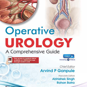 Operative Urology Comprehensive Guide
