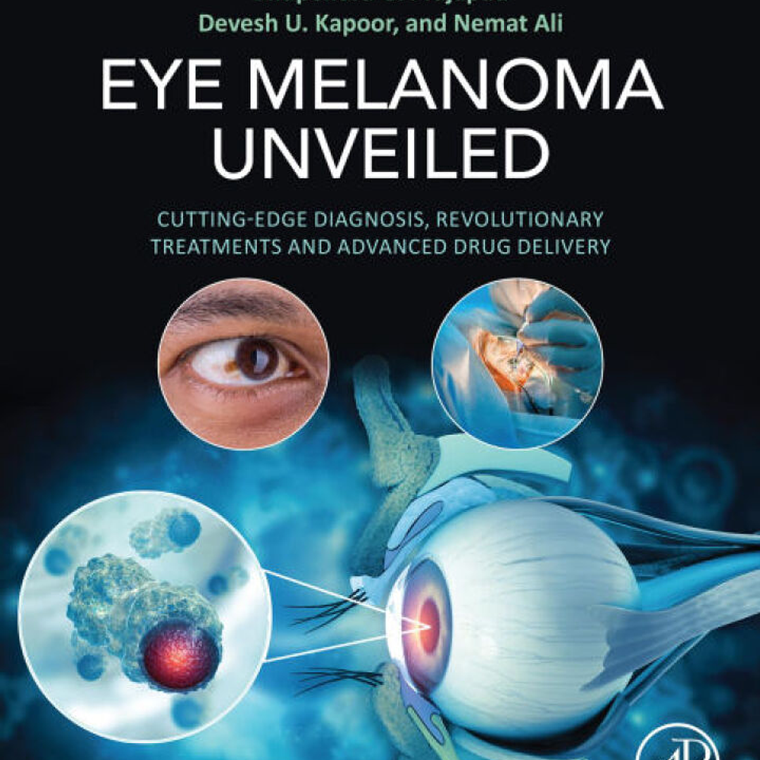 Eye Melanoma Unveiled: Cutting-Edge Diagnosis, Revolutionary Treatments and Advanced Drug Delivery 1