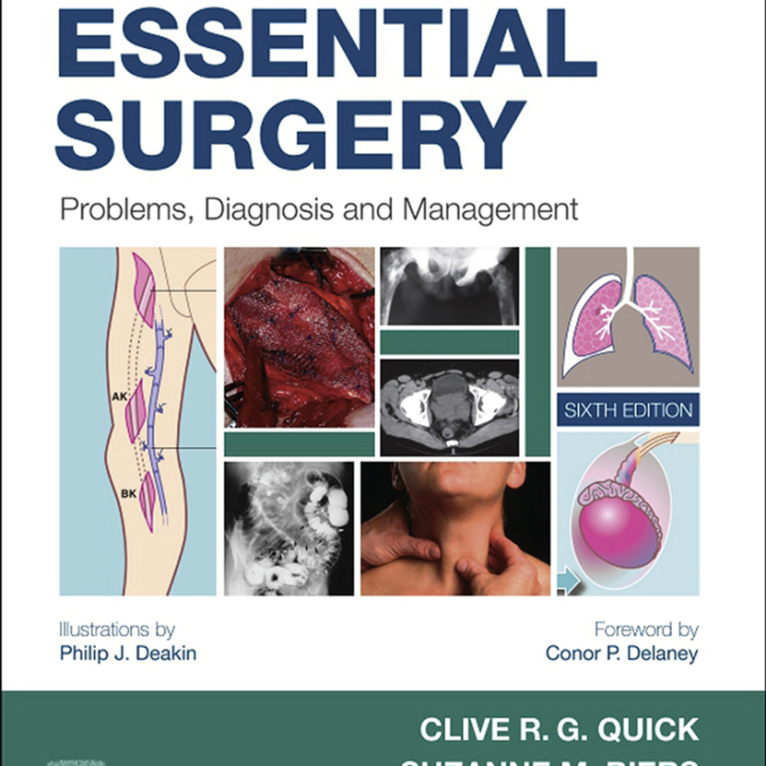 Essential Surgery: Problems, Diagnosis and Management 6th Edition 1