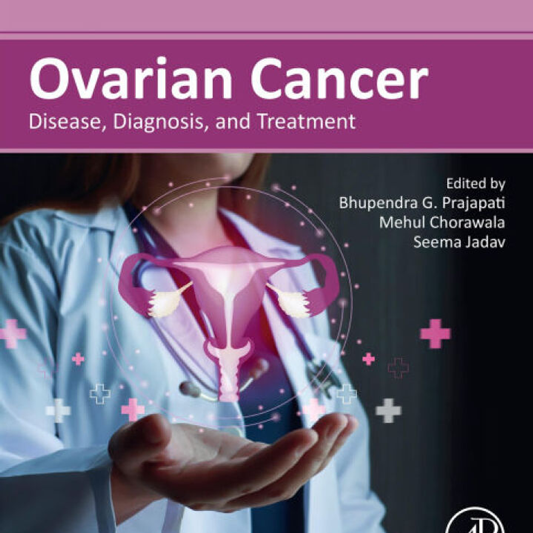 Ovarian Cancer: Disease, Diagnosis, and Treatment 1