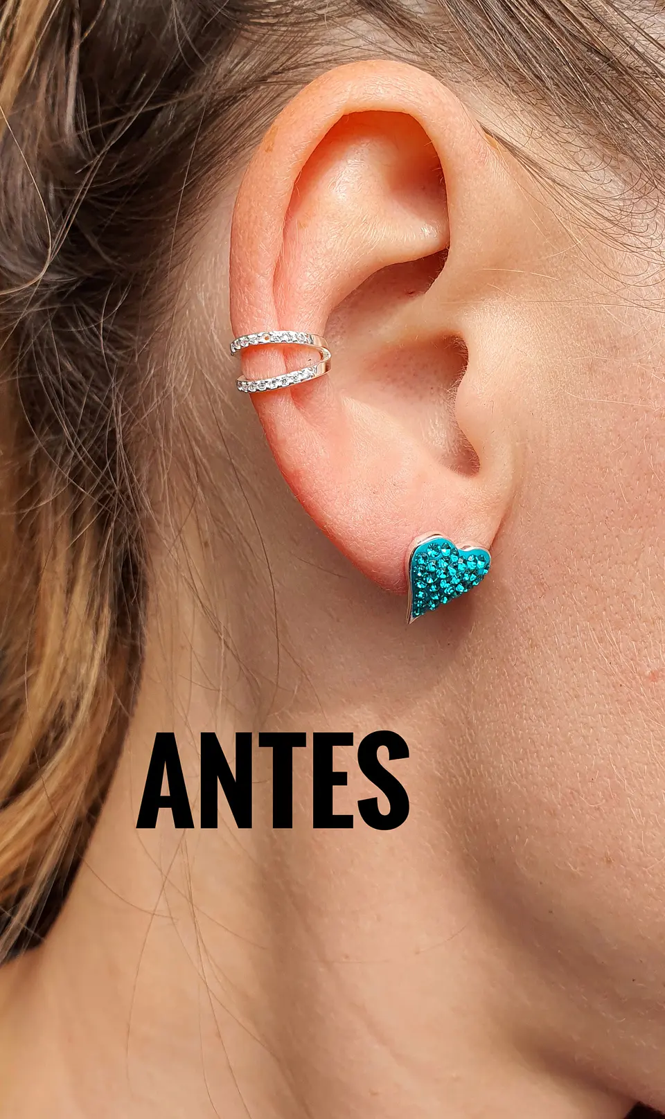 Levantadores de aros  2