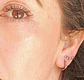 Piercing Labret Astm F136 Titanio Tragus Trepador 8mm - Miniatura 3