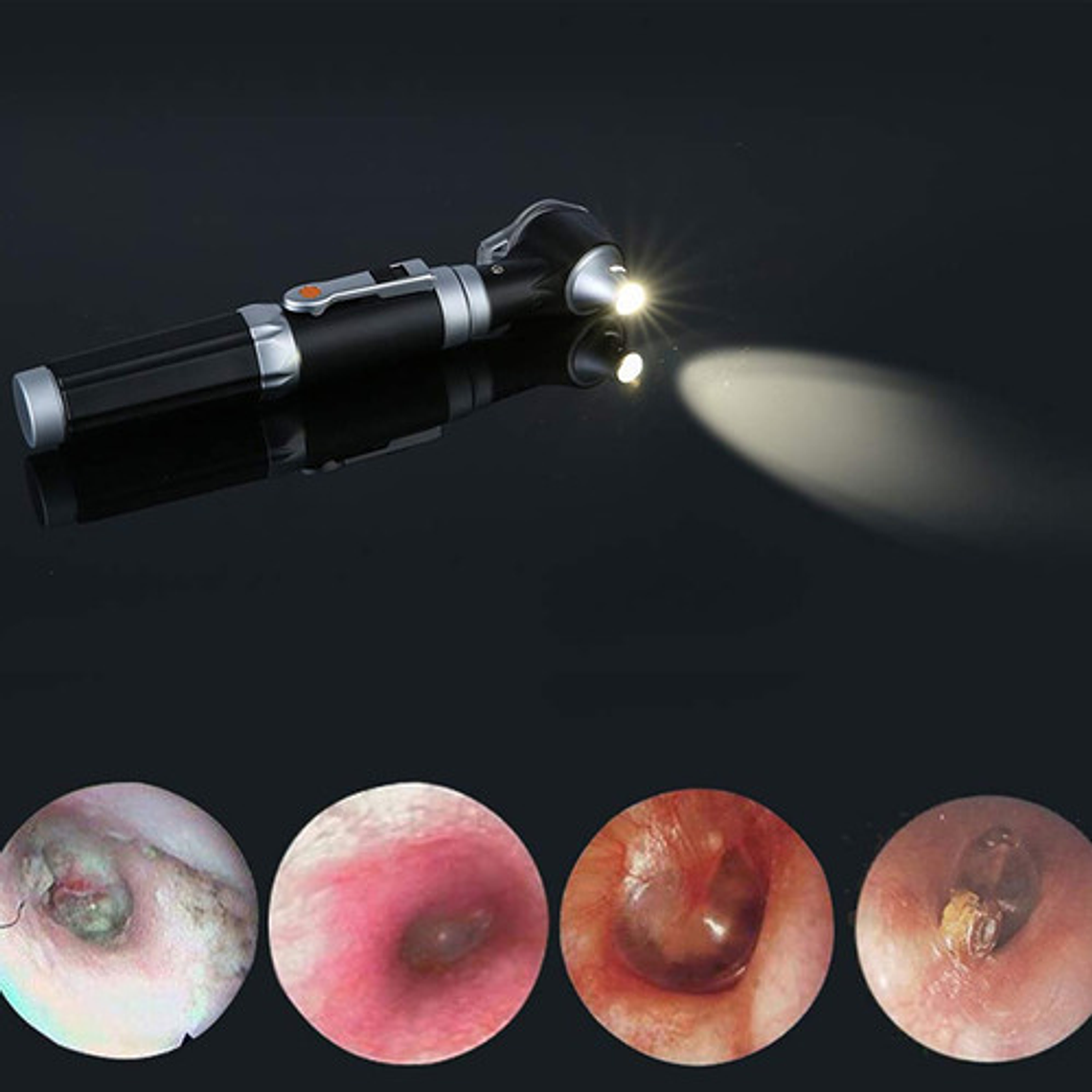 Otoscopio Profesional Porta Diagnostico Oido Luz Led Zoom X3 3