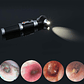 Otoscopio Profesional Porta Diagnostico Oido Luz Led Zoom X3 - Miniatura 3