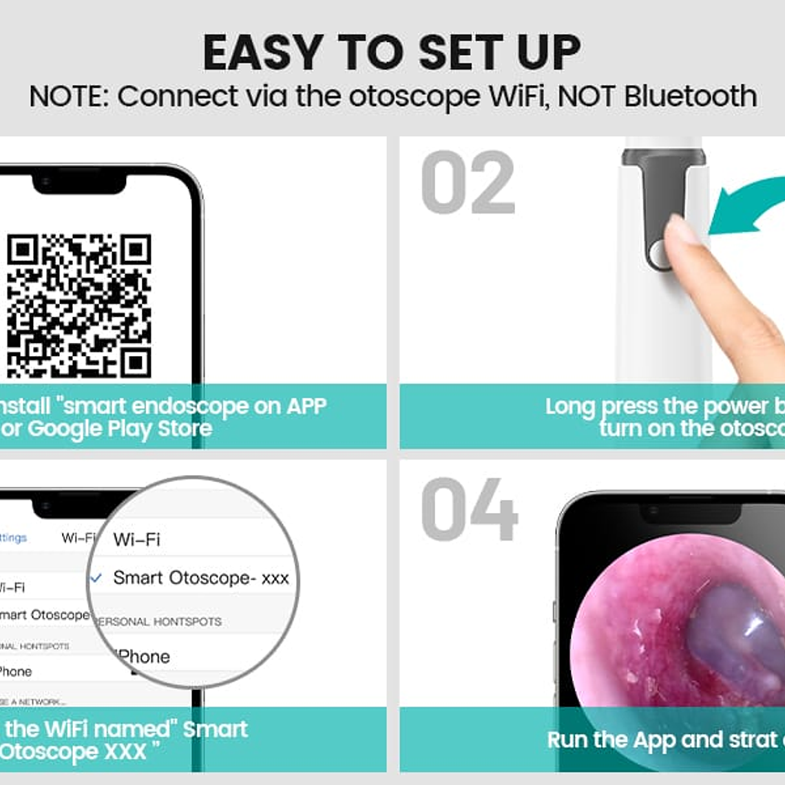 Otoscopio Inalámbrico Wifi Cámara Oído Luz Led Profesional 11