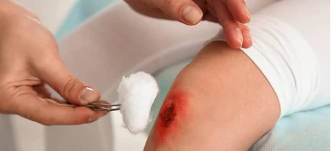 Curaciones de Heridas y Manejo de Lesiones