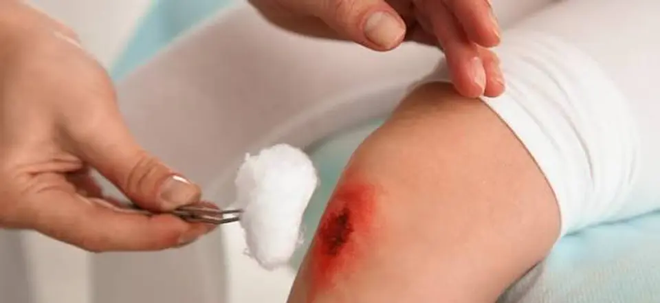 Curaciones de Heridas y Manejo de Lesiones 1
