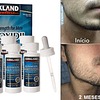 Oferta 3 Frascos Minoxidil 5% + Envío Gratis 