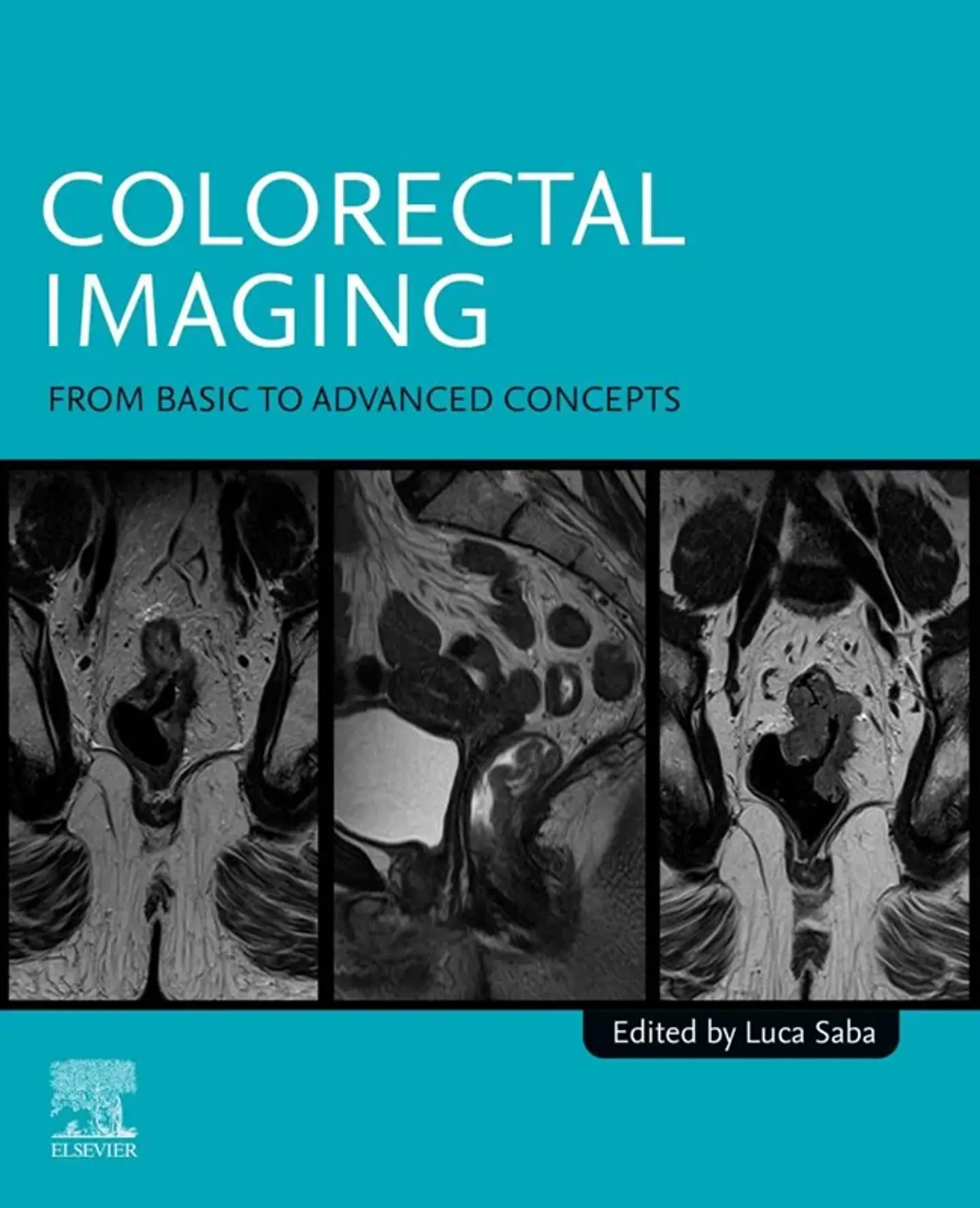 Colorectal Imaging: From Basic to Advanced Concepts 1