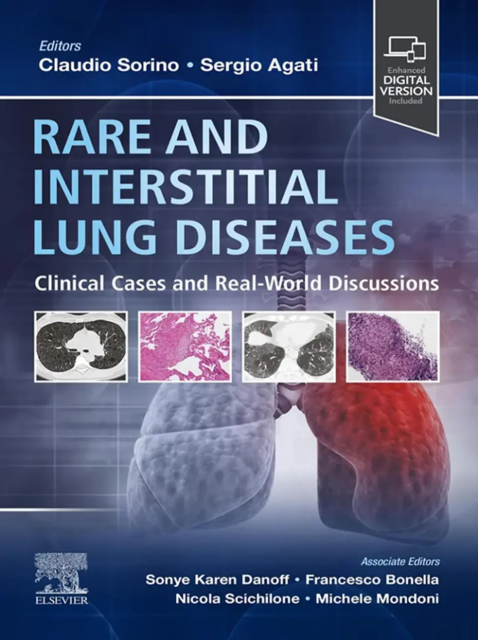 Rare and Interstitial Lung Diseases: Clinical Cases and Real-World Discussions 1