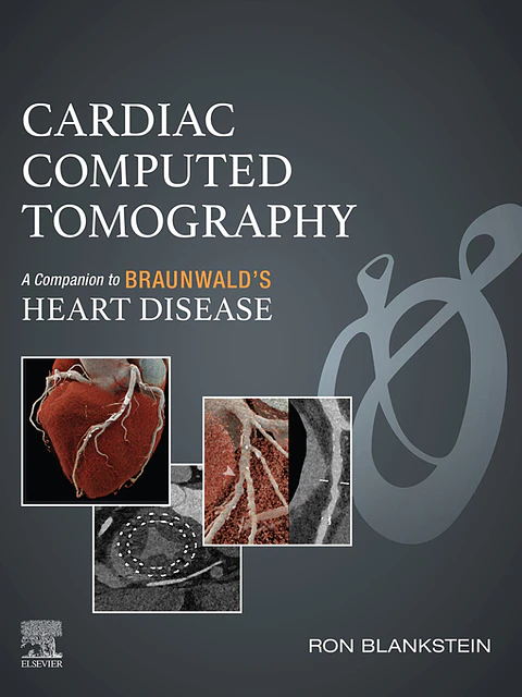Cardiac Computed Tomography: A Companion to Braunwald's Heart Disease