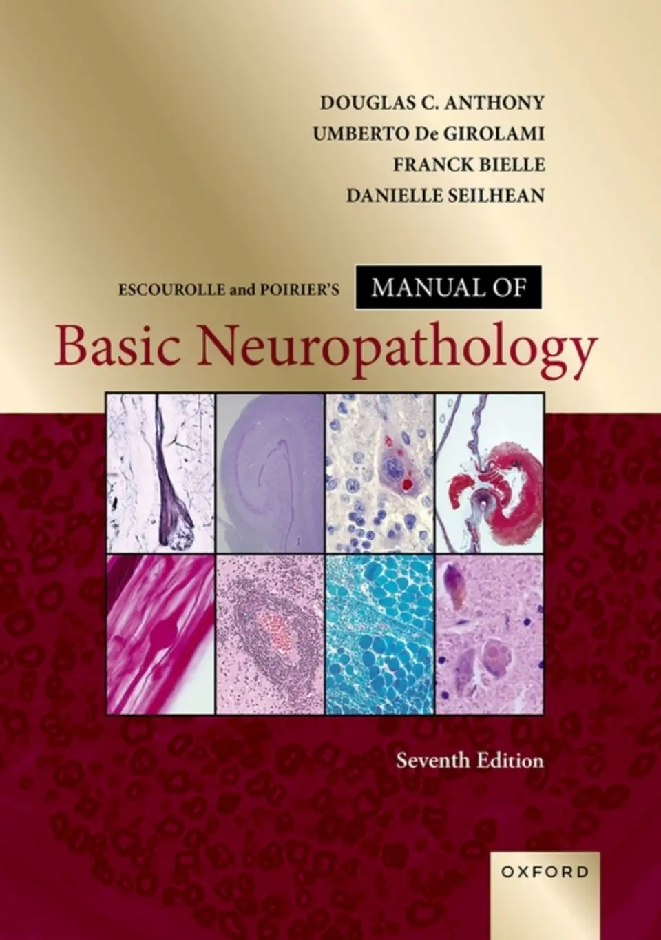 Escourolle and Poirier's Manual of Basic Neuropathology 7th Edition 1