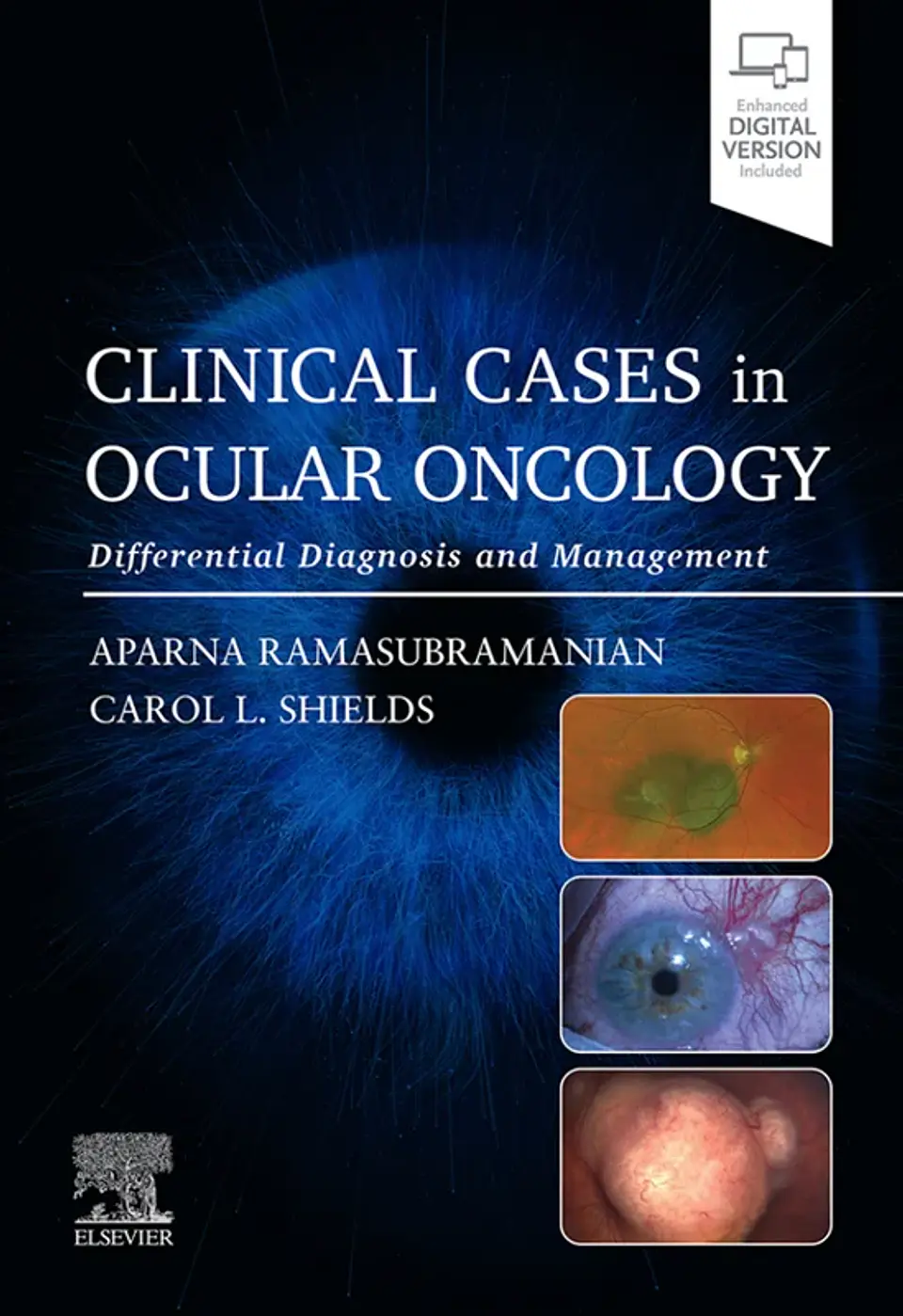 Clinical Cases in Ocular Oncology: Differential Diagnosis and Management 1