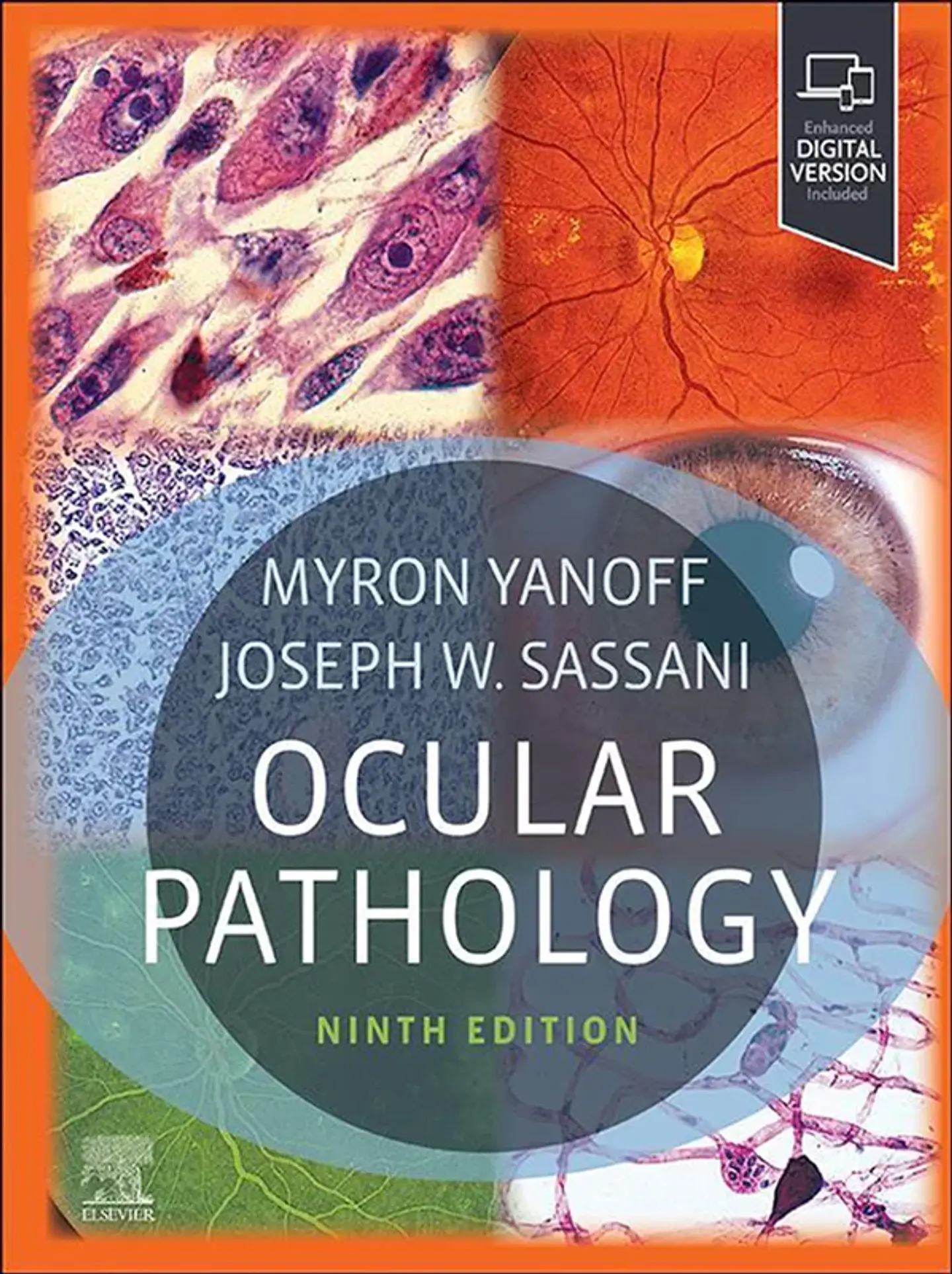 Ocular Pathology 9th Edition 1