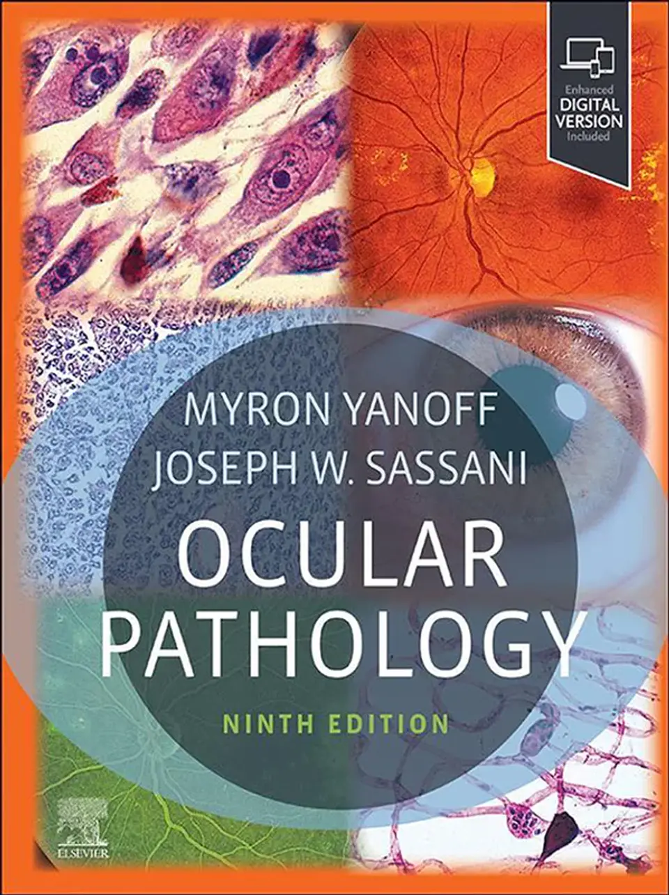 Ocular Pathology 9th Edition 1