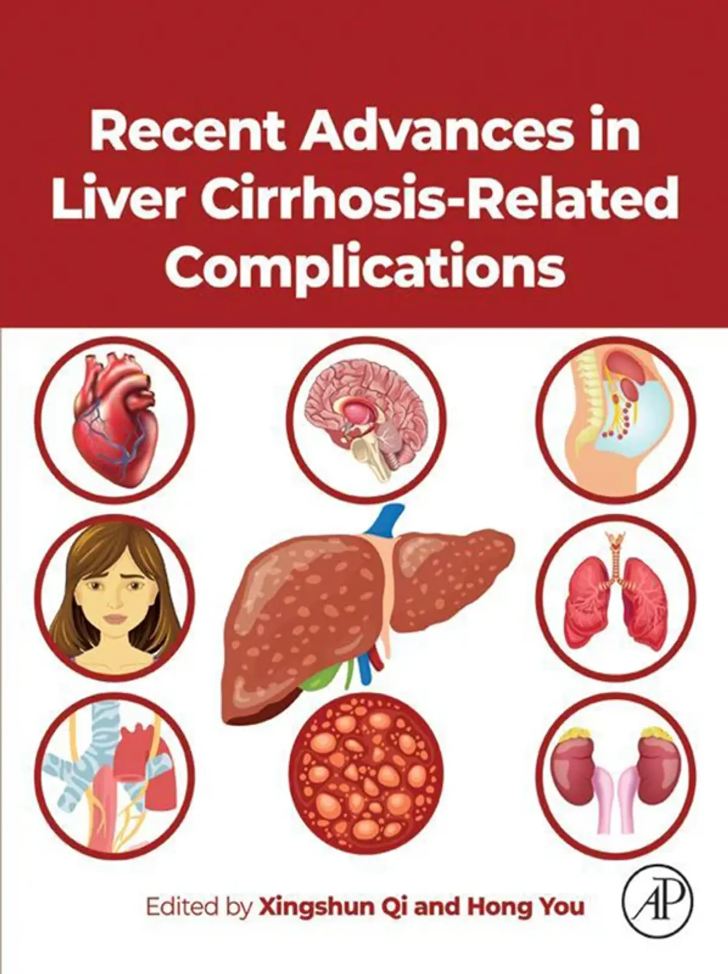 Recent Advances in Liver Cirrhosis Related Complications 1