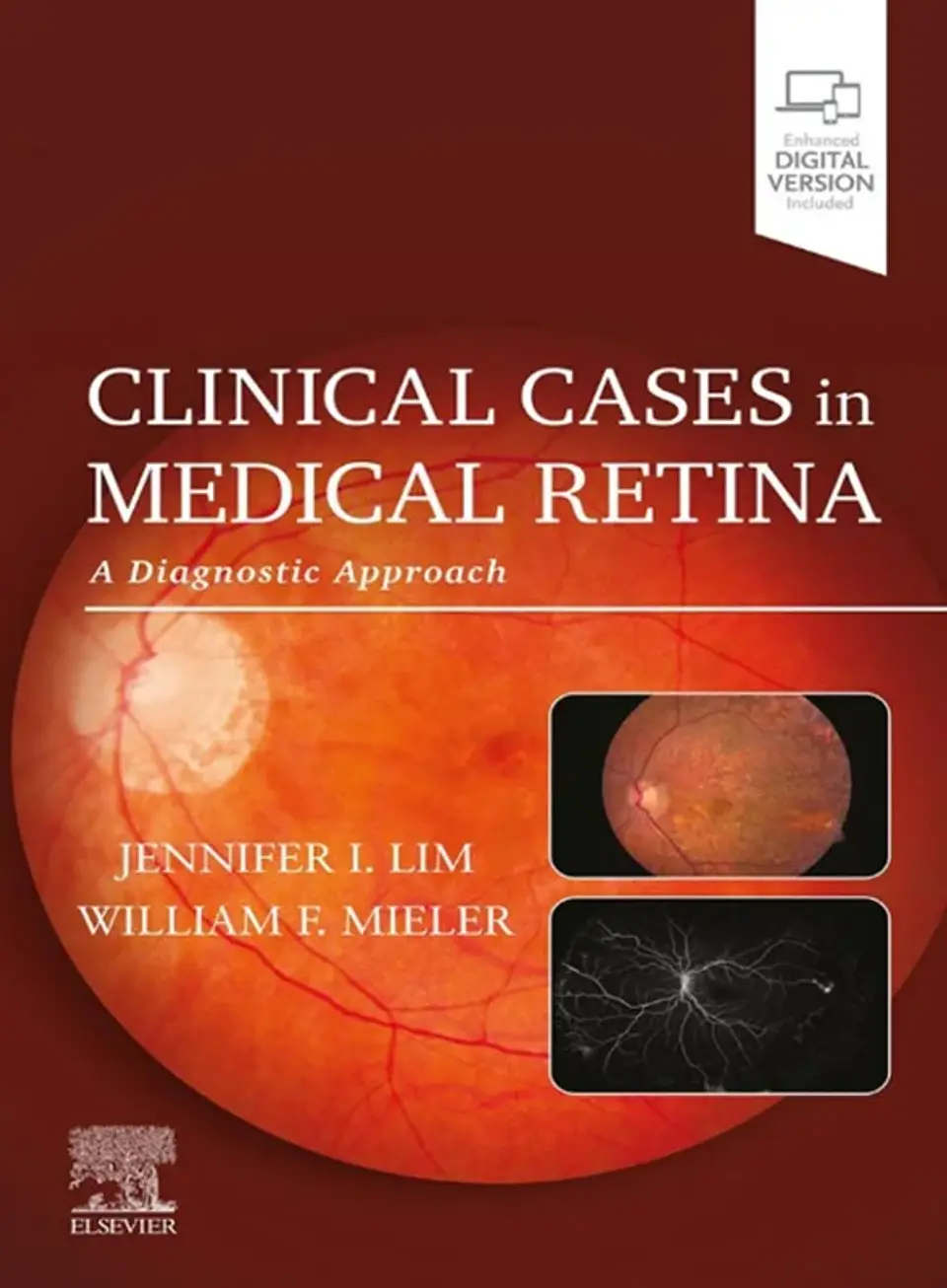 Clinical Cases in Medical Retina: A Diagnostic Approach 1