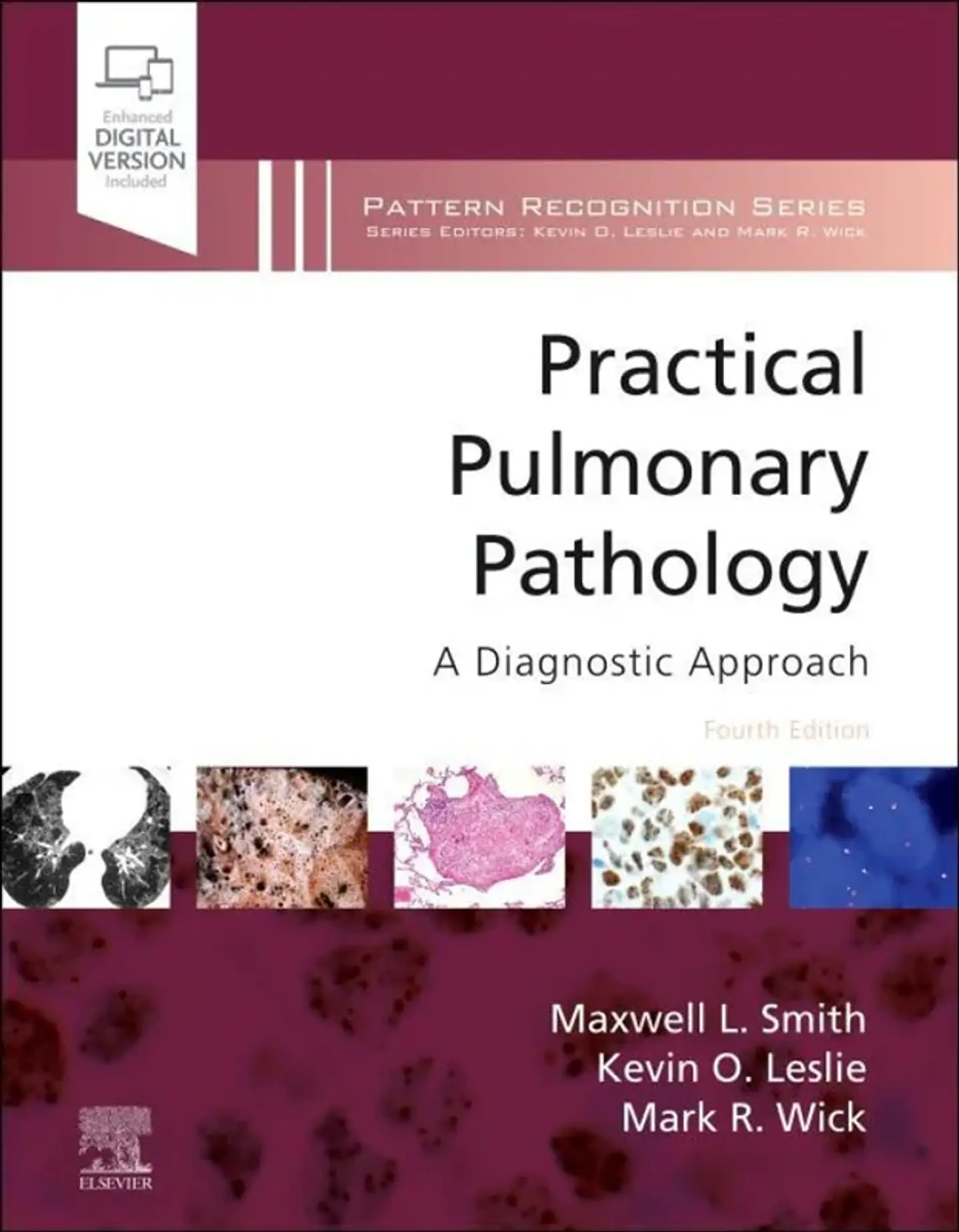 Practical Pulmonary Pathology: A Diagnostic Approach 4th Edition 1