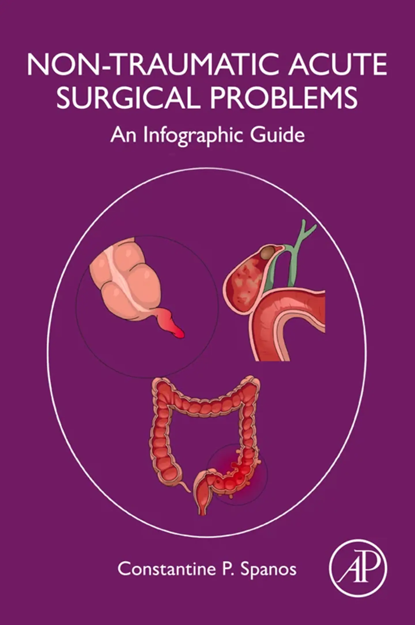 Non-Traumatic Acute Surgical Problems: An Infographic Guide 1