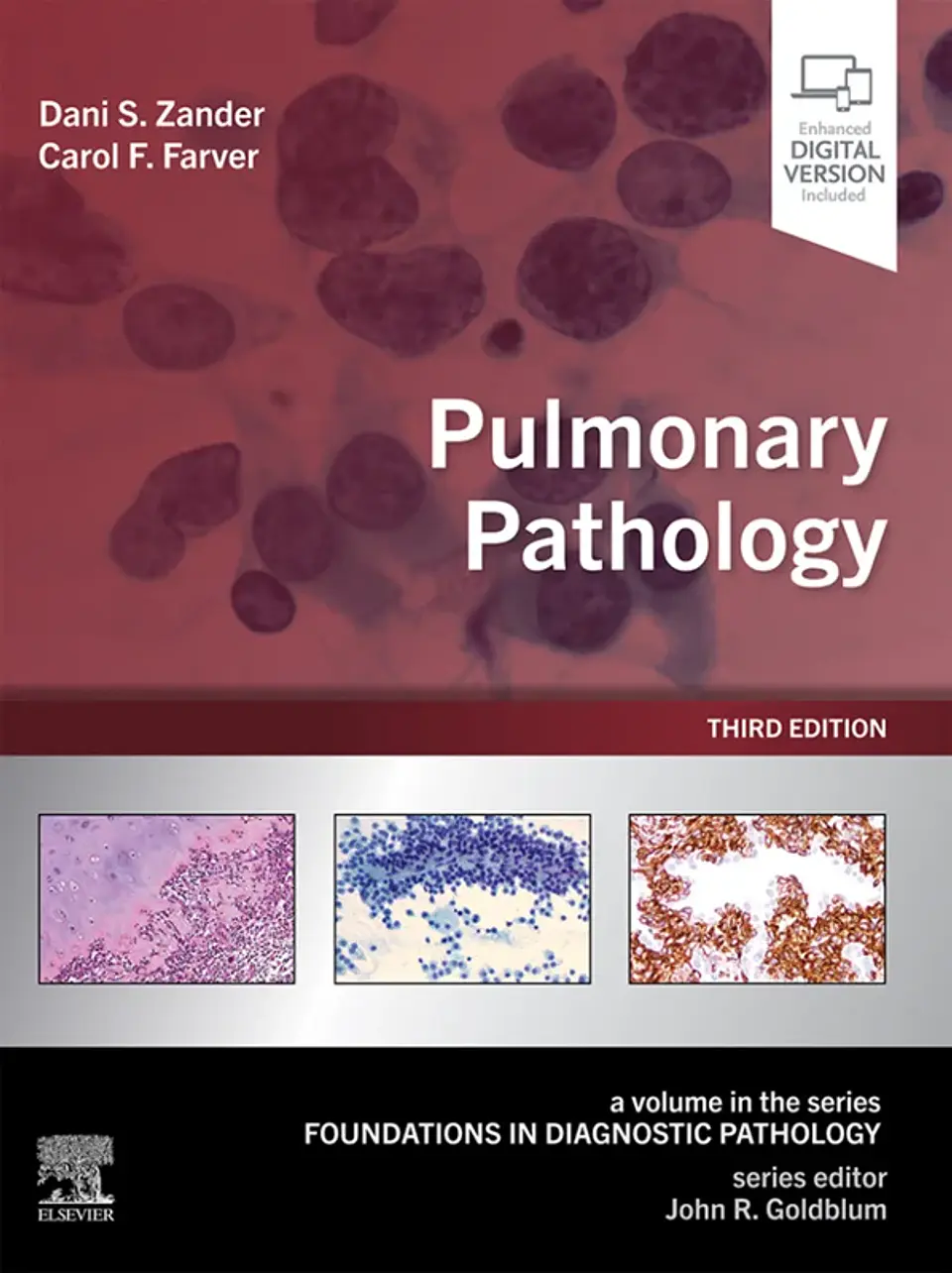 Pulmonary Pathology 3rd Edition 1