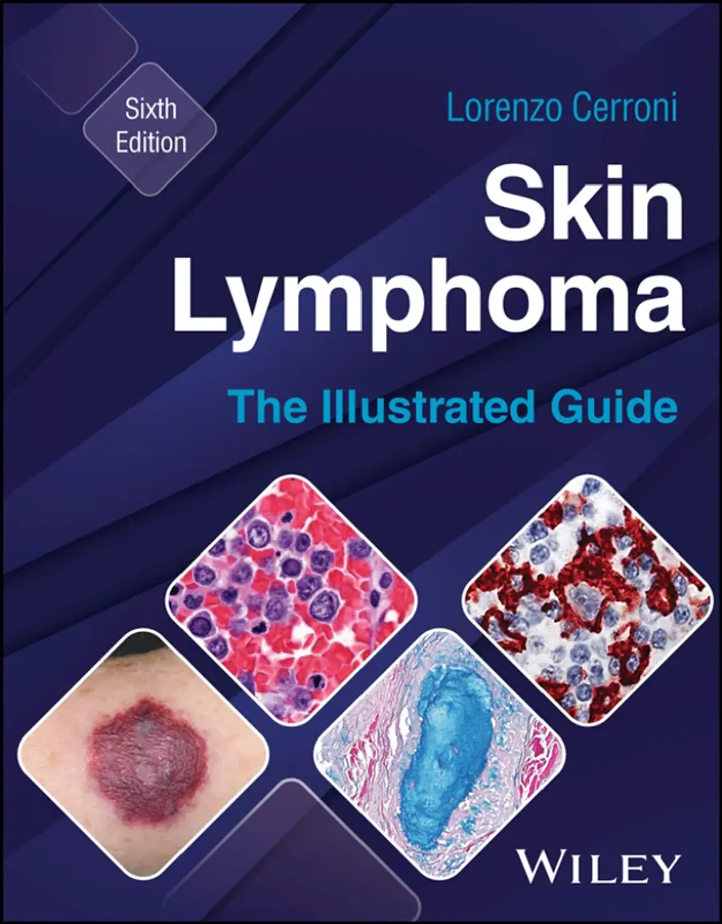 Skin Lymphoma: The Illustrated Guide 6th Edition 1