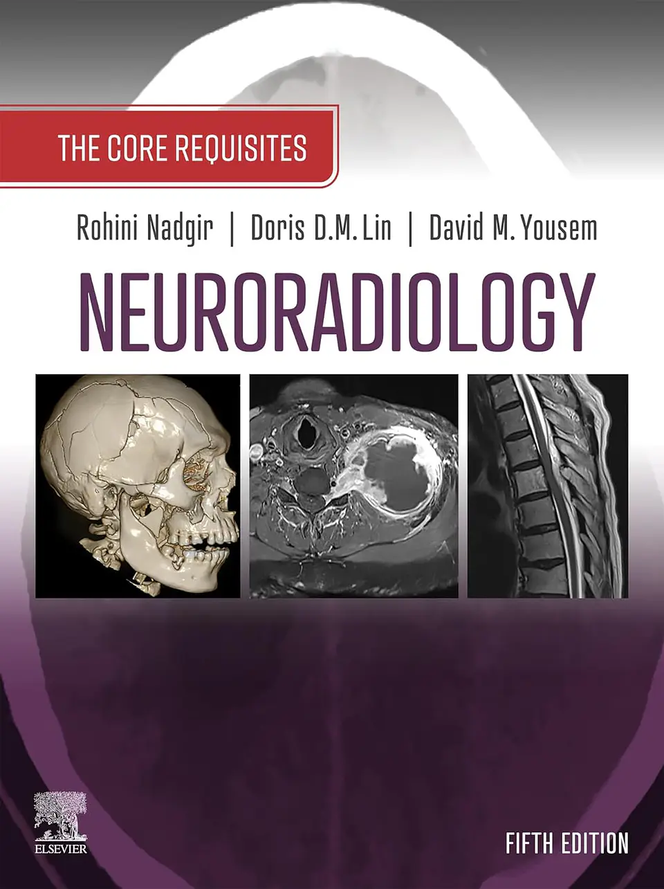  Neuroradiology: The Requisites: The Core Requisites 5th Edition  1
