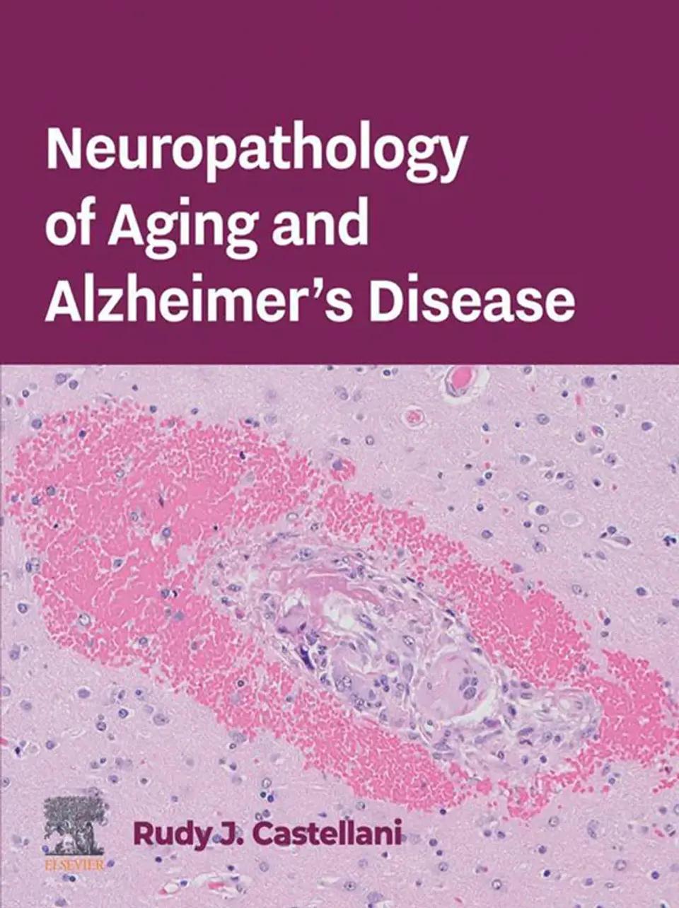 Neuropathology of Aging and Alzheimer's Disease 1