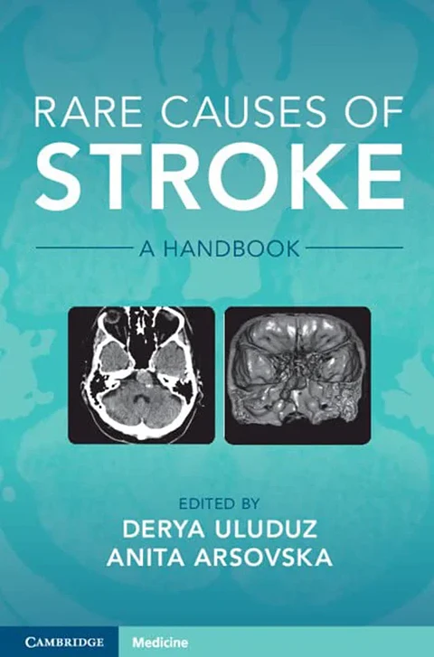 Rare Causes of Stroke: A Handbook