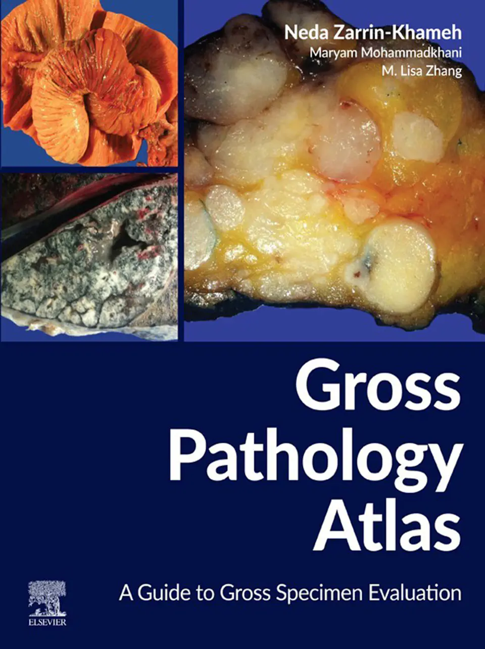 Gross Pathology Atlas: A Guide to Gross Specimens Evaluation 1