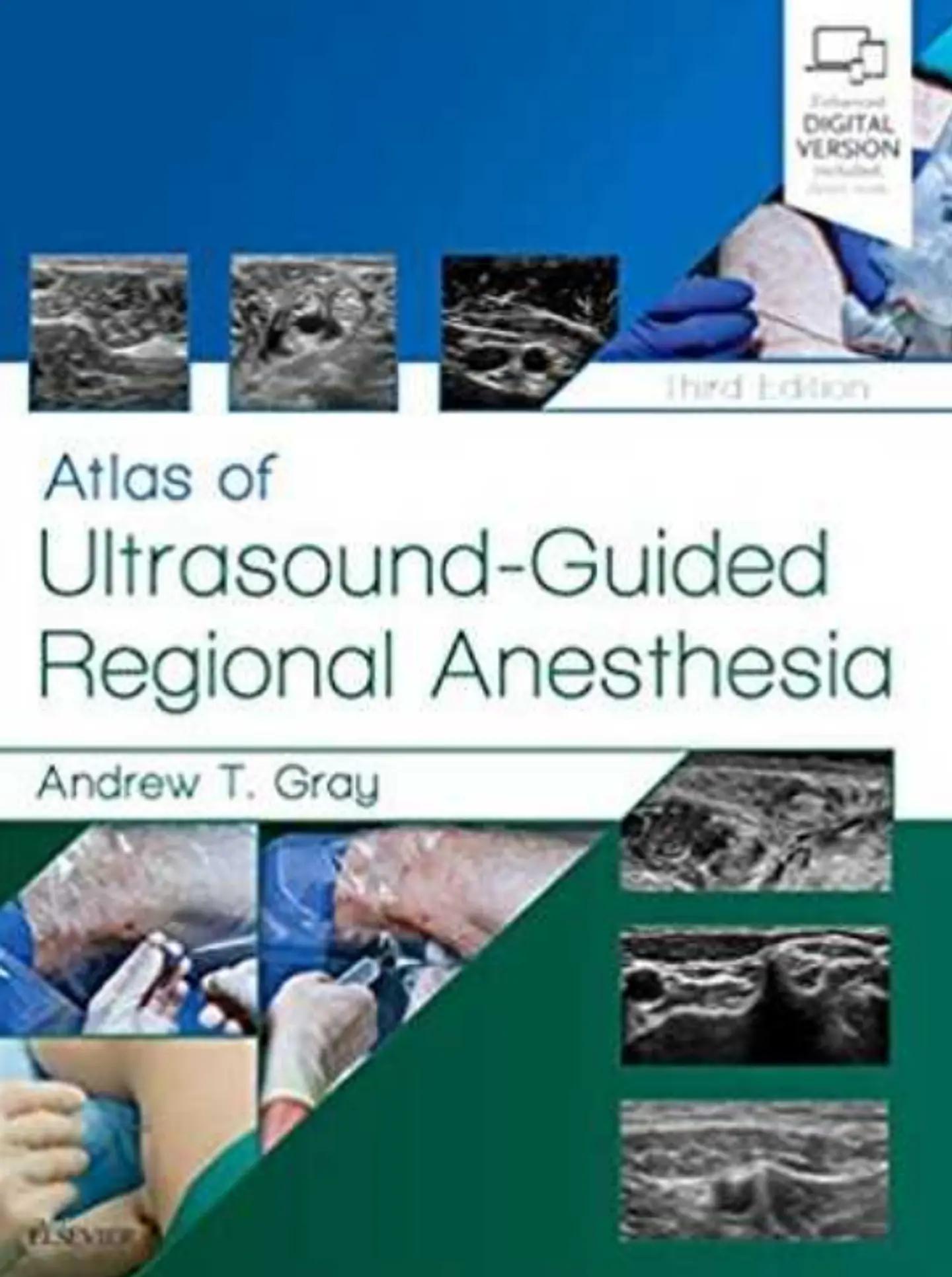 Atlas of Ultrasound-Guided Regional Anesthesia 1