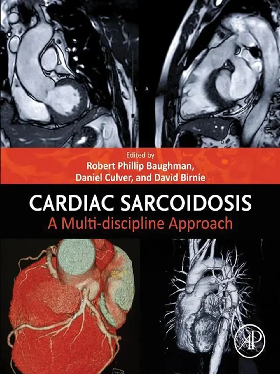 Cardiac Sarcoidosis: A Multi-discipline Approach 1