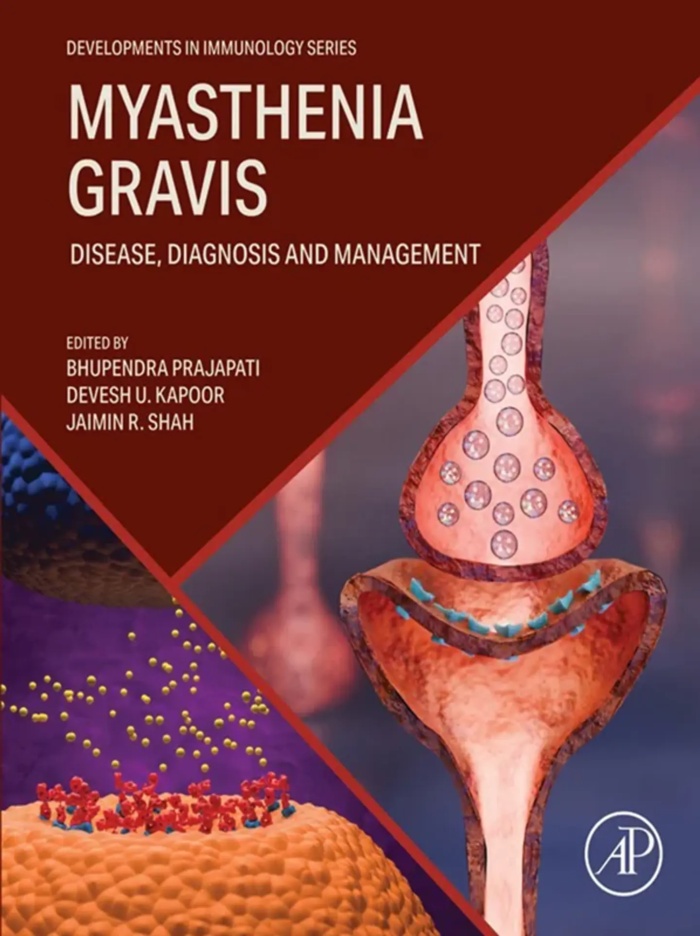 Myasthenia Gravis: Disease, Diagnosis and Management 1