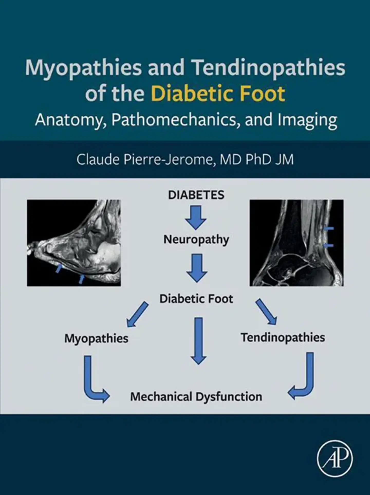 Myopathies and Tendinopathies of the Diabetic Foot: Anatomy, Pathomechanics, and Imaging 1