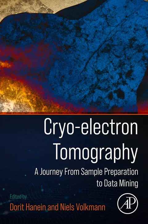 Cryo-electron Tomography: A Journey from Sample Preparation to Data Mining